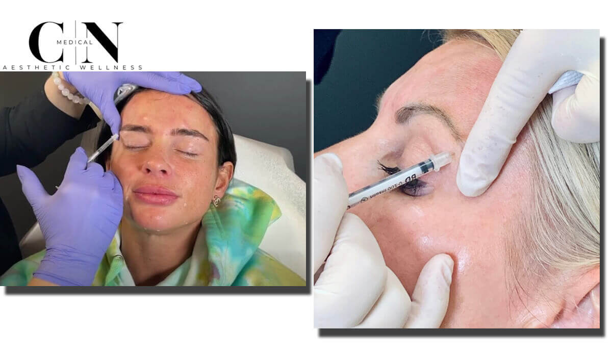 Women getting botox treatment on their face.
