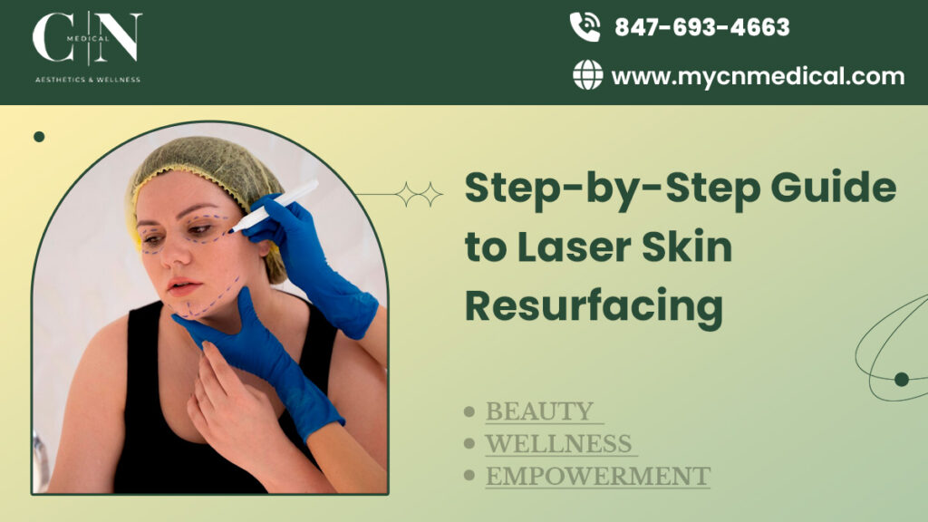 Step by Step Guide to Laser Skin Resurfacing