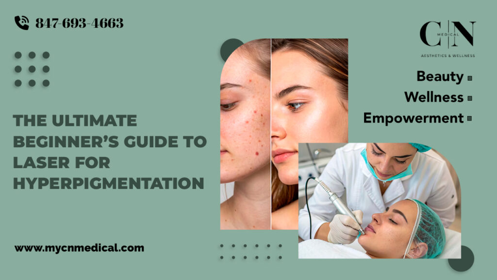 THE ULTIMATE BEGINNER'S GUIDE TO LASER FOR HYPERPIGMENTATION