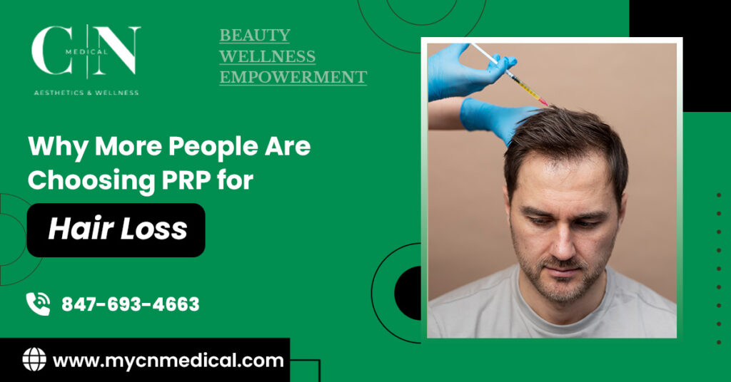 Why More People Are Choosing PRP for Hair Loss