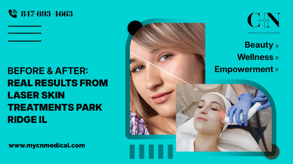 Before & After: Real Results from Laser Skin Treatments in Park Ridge, IL