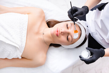 chemical-peel.jpg