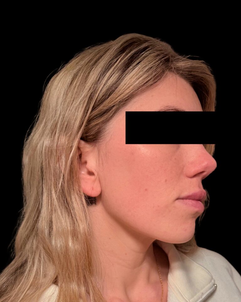 After Image: Combined Treatments - right-side
