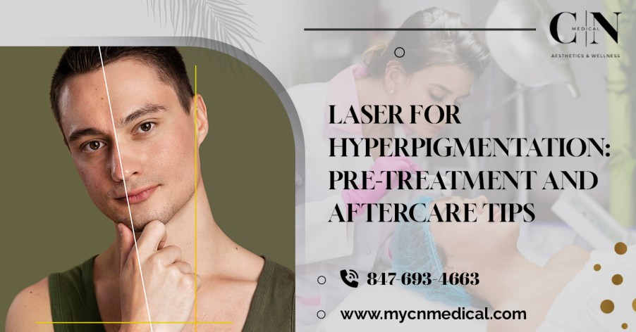 Laser for Hyperpigmentation: Pre-Treatment and Aftercare Tips