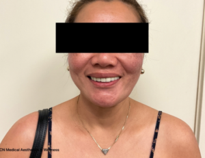 After Image: Jeuveau