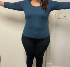 Before Image: Skinny Shot