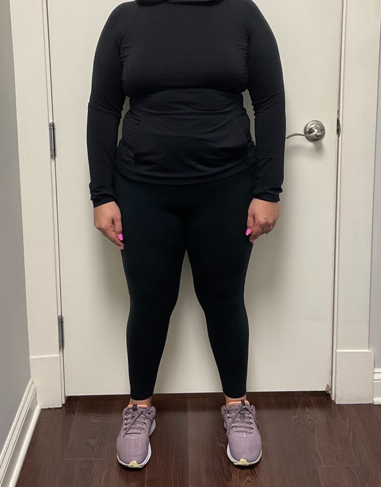 Before Image: Skinny Shot - front