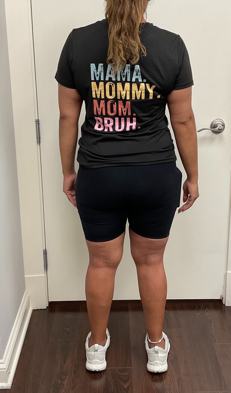 After Image: Skinny Shot - back