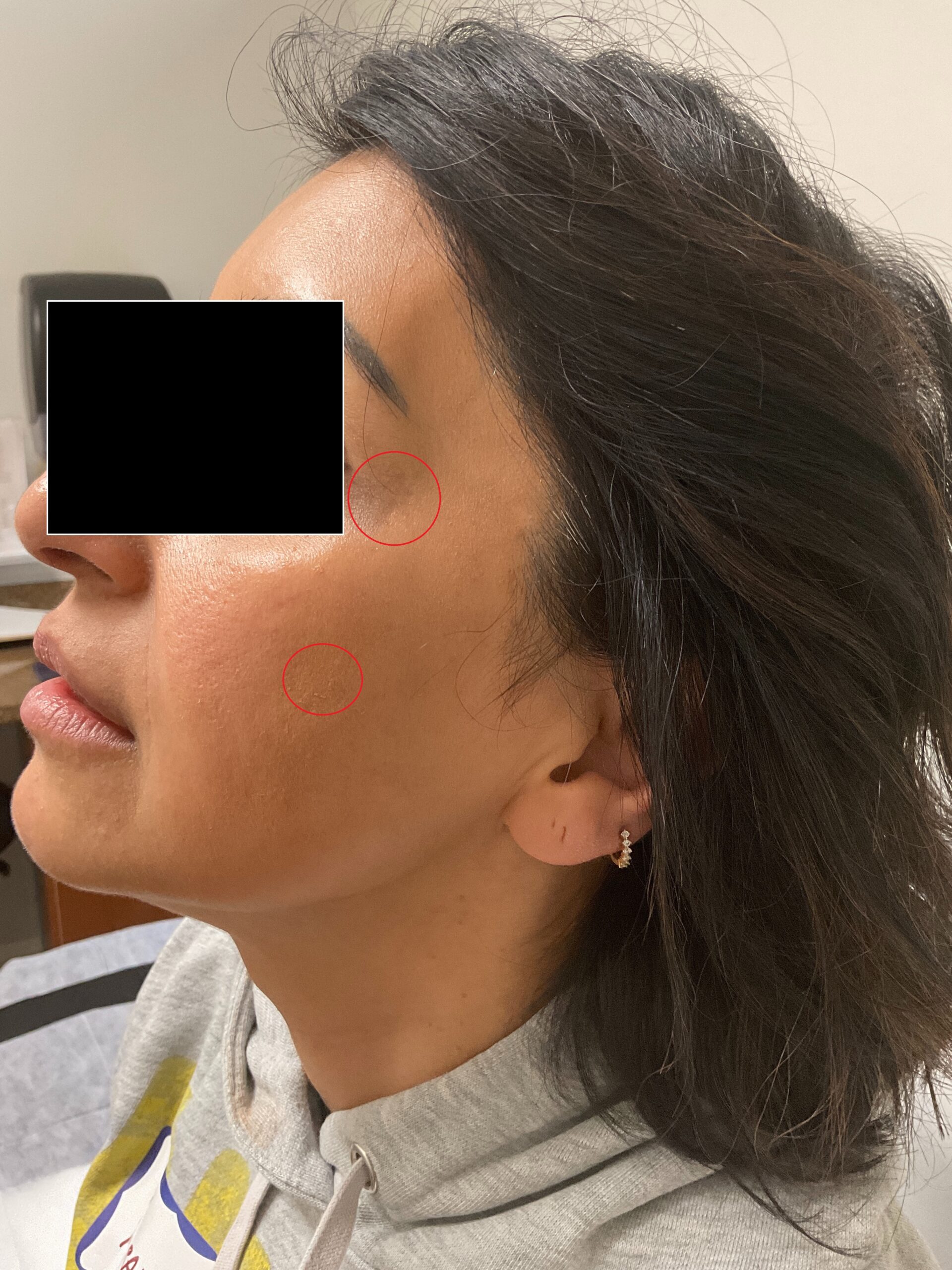 After Image: IPL - front