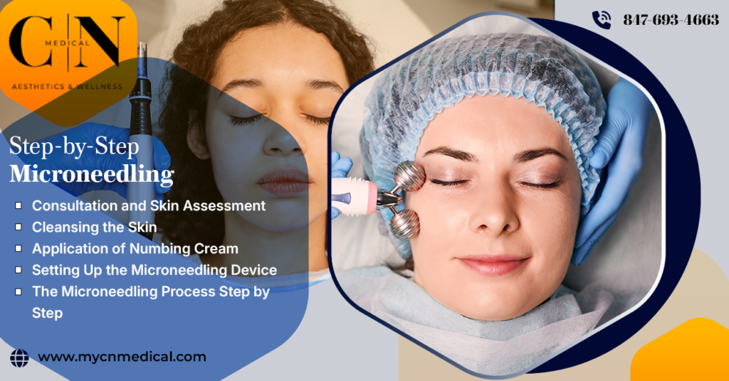 Step by Step Microneedling