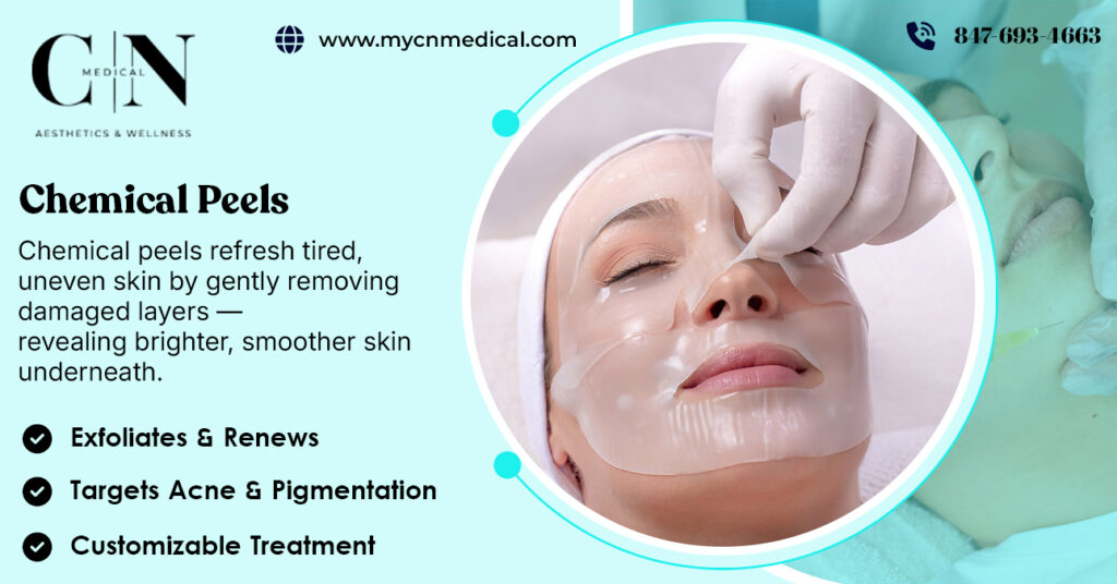 Chemical Peels Explained
