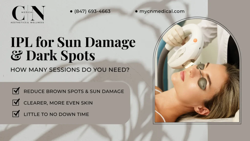 IPL for Sun Damage and Brown Spots