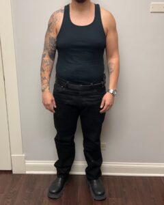 After Image: Skinny Shot (Glp-1 Weight Loss Program)