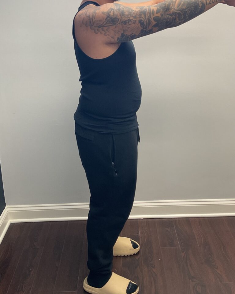 Before Image: Skinny Shot (Glp-1 Weight Loss Program) - right-side