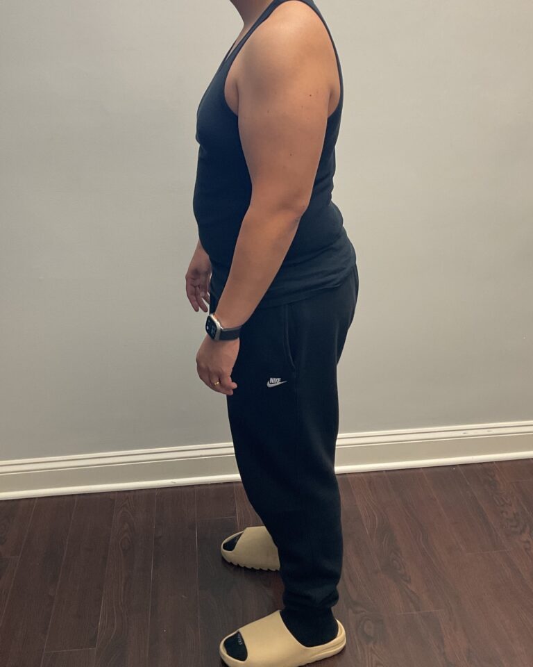 Before Image: Skinny Shot (Glp-1 Weight Loss Program) - left-side